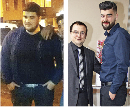 Opr. Dr. Fakı Akın anlattı: Şişmanlığa neşterli çözüm
